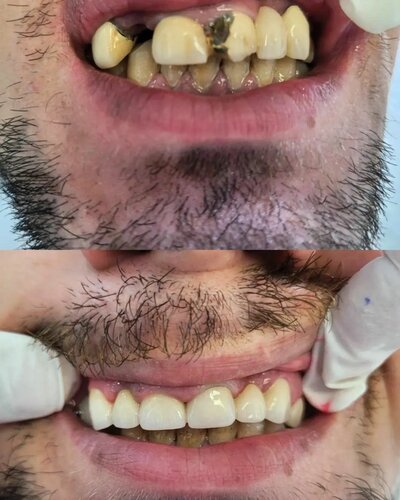 Ahsendent Ağız Ve Diş Sağlığı Polikliniği